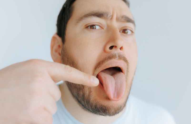 Identifier la cause du bouton pour mieux le traiter-Handissimo