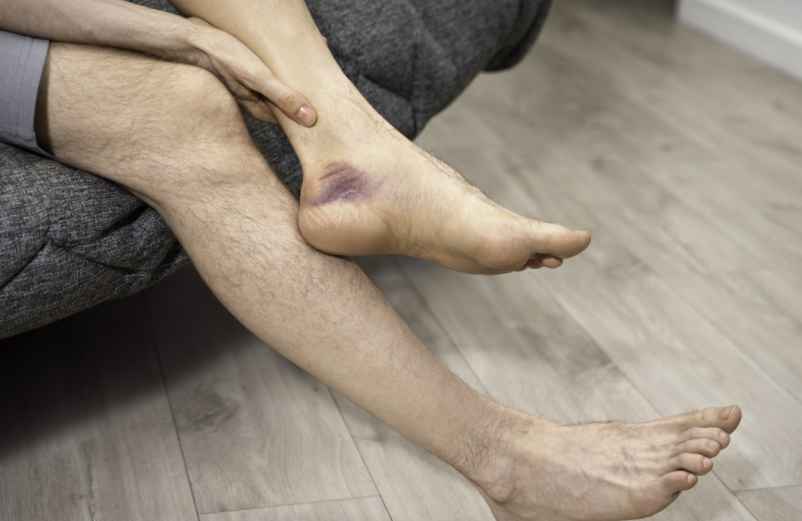 Manque de fer : quels symptômes dans les jambes ?-Handissimo