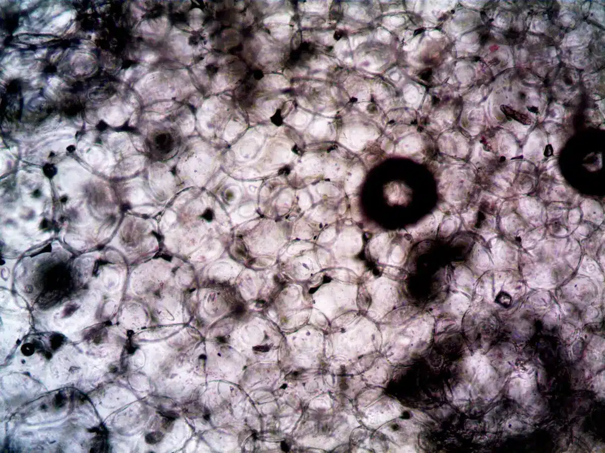Illustration scientifique montrant le rôle du tissu adipeux dans l'inflammation