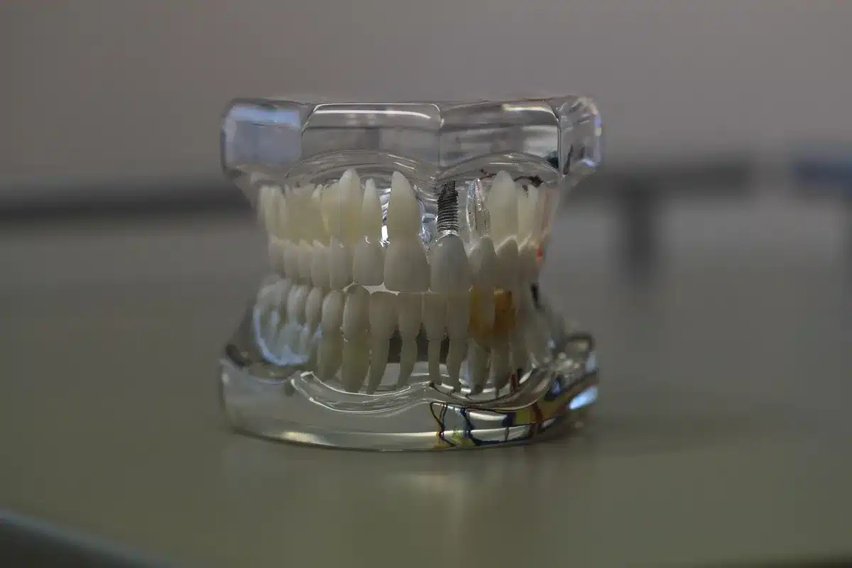 Dentiste palpant les muscles de la mâchoire lors d'un examen clinique